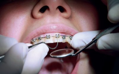 uss-postitulo-Odontológica-Ortodoncia