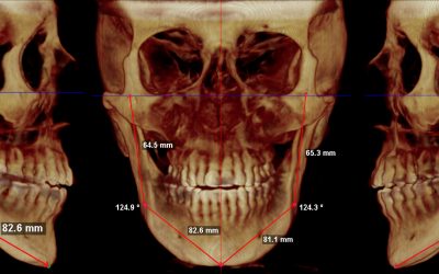 diplomado-diagnostico-3d-ortodoncia-ortopedia